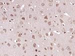 Caspase-6 subunit p11 Antibody in Immunohistochemistry (Paraffin) (IHC (P))