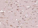 Caspase-6 subunit p11 Antibody in Immunohistochemistry (Paraffin) (IHC (P))