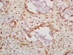 Caspase 14 Antibody in Immunohistochemistry (Paraffin) (IHC (P))