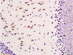 CD11b, CD11c Antibody in Immunohistochemistry (Paraffin) (IHC (P))