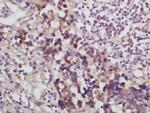 Desmoglein 2 Antibody in Immunohistochemistry (Paraffin) (IHC (P))