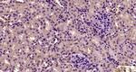 Desmoglein 2 Antibody in Immunohistochemistry (Paraffin) (IHC (P))