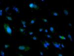 ALDH1 Antibody in Immunocytochemistry (ICC/IF)