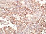 ALDH1 Antibody in Immunohistochemistry (Paraffin) (IHC (P))