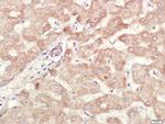 ALDH1 Antibody in Immunohistochemistry (Paraffin) (IHC (P))