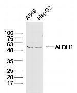 ALDH1 Antibody in Western Blot (WB)