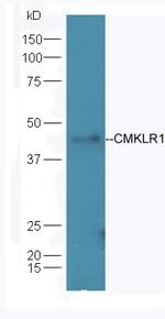 CMKLR1 Antibody in Western Blot (WB)