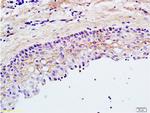 TLR2 Antibody in Immunohistochemistry (Paraffin) (IHC (P))