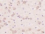 TLR2 Antibody in Immunohistochemistry (Paraffin) (IHC (P))