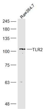 TLR2 Antibody in Western Blot (WB)