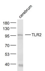 TLR2 Antibody in Western Blot (WB)