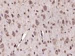 TrkA Antibody in Immunohistochemistry (Paraffin) (IHC (P))