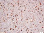 HER4/ErbB4 Antibody in Immunohistochemistry (Paraffin) (IHC (P))