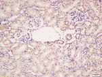 HER4/ErbB4 Antibody in Immunohistochemistry (Paraffin) (IHC (P))