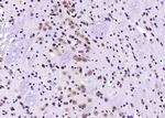 HER4/ErbB4 Antibody in Immunohistochemistry (Paraffin) (IHC (P))