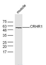 CRHR1 Antibody in Western Blot (WB)