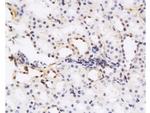 HGF Antibody in Immunohistochemistry (Paraffin) (IHC (P))