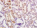 Desmin Antibody in Immunohistochemistry (Paraffin) (IHC (P))