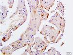 Desmin Antibody in Immunohistochemistry (Paraffin) (IHC (P))