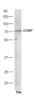 COMP Antibody in Western Blot (WB)