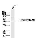 Cytokeratin 19 Antibody in Western Blot (WB)