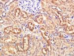 KRAS Antibody in Immunohistochemistry (Paraffin) (IHC (P))