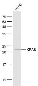 KRAS Antibody in Western Blot (WB)