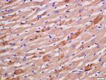 Sarcomeric Alpha Actinin Antibody in Immunohistochemistry (Paraffin) (IHC (P))