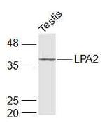 LPA2 Antibody in Western Blot (WB)