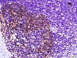 Galectin-3 Antibody in Immunohistochemistry (Paraffin) (IHC (P))