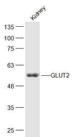 GLUT2 Antibody in Western Blot (WB)