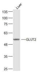 GLUT2 Antibody in Western Blot (WB)