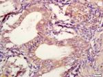 TIMP-2 Antibody in Immunohistochemistry (Paraffin) (IHC (P))