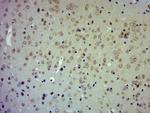 TIMP-2 Antibody in Immunohistochemistry (Paraffin) (IHC (P))