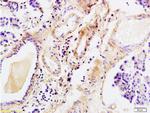 Tenascin C Antibody in Immunohistochemistry (Paraffin) (IHC (P))