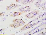 Tenascin C Antibody in Immunohistochemistry (Paraffin) (IHC (P))