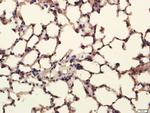 Pan Cytokeratin/p-CK Antibody in Immunohistochemistry (Paraffin) (IHC (P))