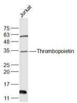 Thrombopoietin Antibody in Western Blot (WB)