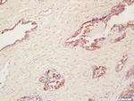 Cyclooxygenase 2 Antibody in Immunohistochemistry (Paraffin) (IHC (P))