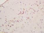 Cyclooxygenase 2 Antibody in Immunohistochemistry (Paraffin) (IHC (P))