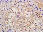 VEGFR2 Antibody in Immunohistochemistry (Paraffin) (IHC (P))