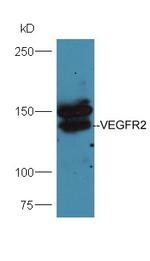 VEGFR2 Antibody in Western Blot (WB)