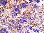 Collagen 1 Antibody in Immunohistochemistry (Paraffin) (IHC (P))