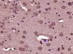 Collagen 1 Antibody in Immunohistochemistry (Paraffin) (IHC (P))