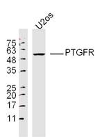 PTGFR Antibody in Western Blot (WB)