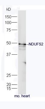 NDUFS2 Antibody in Western Blot (WB)