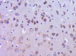 DYNC1I2 Antibody in Immunohistochemistry (Paraffin) (IHC (P))