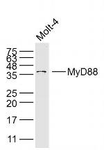 MyD88 Antibody in Western Blot (WB)