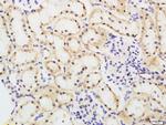 FBXO42 Antibody in Immunohistochemistry (Paraffin) (IHC (P))