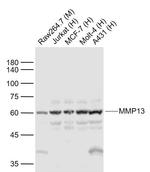 MMP13 Antibody in Western Blot (WB)